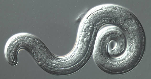 Burning-in-womans-legs-turned-out-to-be-slug-parasites.jpg Burning in woman’s legs turned out to be slug parasites migrating to her brain